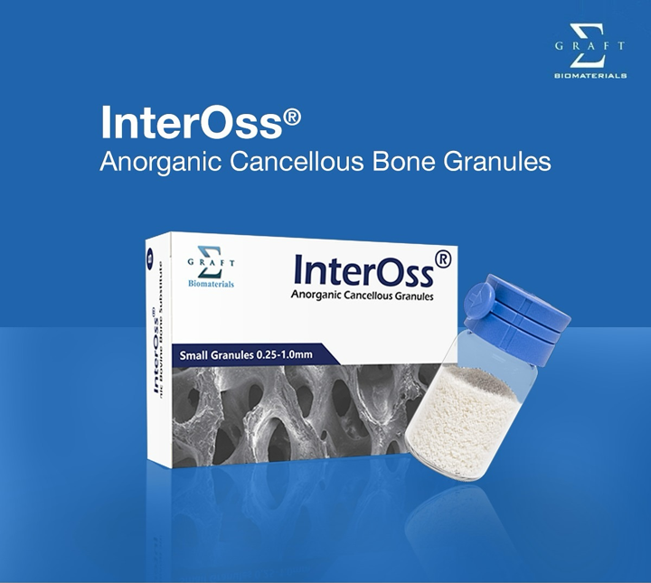 inpixelstore's tweet image. 💡 SigmaGraft InterOss® Xenograft ensures predictable regeneration with a biocompatible, high-porosity scaffold for long-term success.
🦷 Shop now at Inpixel Store!  inpixelstore.com/product/sigma-…
 #SigmaGraft #InterOss #Xenograft #InpixelStore