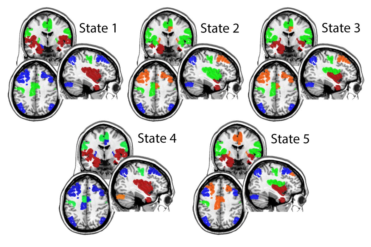 ApertureNeuro (@apertureohbm) on Twitter photo Shappell et al. assess brain network dynamics associated with intentional weight loss in older adults: doi.org/10.52294/001c.…
<a href="/fMRI_today/">Peter Bandettini</a> <a href="/mallarchkrvrty1/">Mallar Chakravarty</a> <a href="/OHBM/">OHBM</a> Shappell et al. assess brain network dynamics associated with intentional weight loss in older adults: doi.org/10.52294/001c.…
<a href="/fMRI_today/">Peter Bandettini</a> <a href="/mallarchkrvrty1/">Mallar Chakravarty</a> <a href="/OHBM/">OHBM</a>