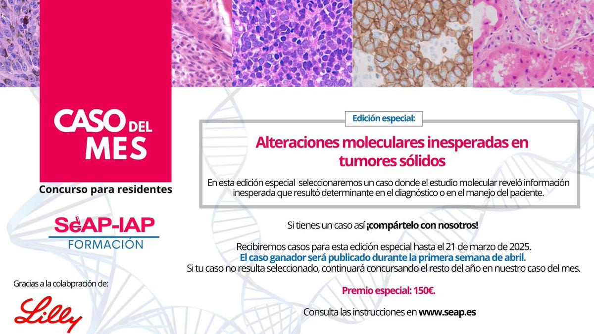 📢¡Atención residentes!
Participa en la edición especial del #CasodelMes. Buscamos casos con alteraciones moleculares inesperadas en tumores sólidos 🧬
📅 Envíos hasta 21 marzo 2025
🏆 Premio 150€ y publicación en abril.
¡No dejes pasar la oportunidad!
ℹ️seap.es