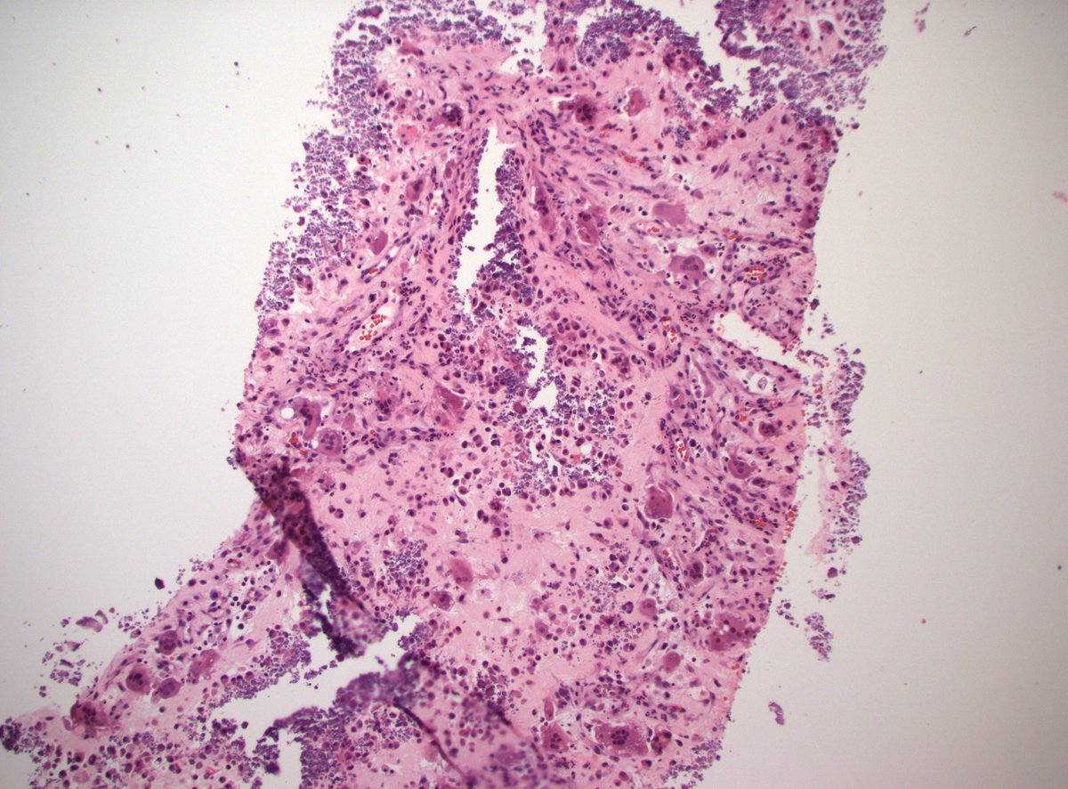 Dan Graham tweet media