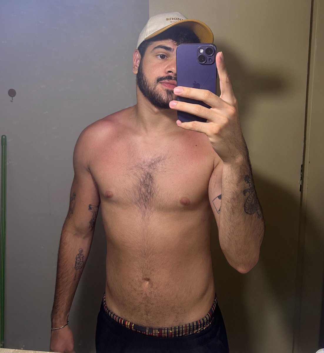 Queimadinho de sol ☀️