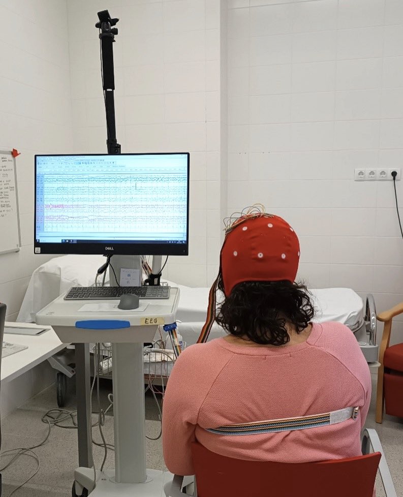 #DiaInternacionalEpilèpsia 🧠 Una malaltia cerebral que afecta a més de 50 milions de persones a tot el món, pot debutar a qualsevol edat de la vida i, aprox., el 70% dels pacients controlen amb la medicació.

#InternationalEpilepsyDay #EpilepsyDay

🔗 salutsantjoan.cat/ca/noticies-i-…
