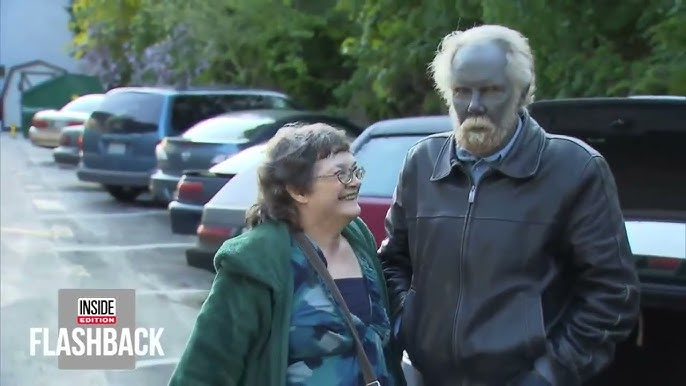 BlindIndex's tweet image. Paul Karason spent years drinking homemade colloidal silver, eventually turning his skin a permanent shade of blue. The rare condition, known as argyria, was caused by silver buildup in his body

his striking appearance made him go viral, but the health risks were real. Though he…