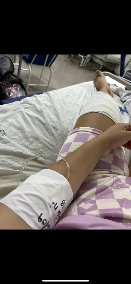 sofiiacsrs's tweet photo. Gracias a la exigencia que había en esa academia me tuvieron q operar de la rodilla por que me salió un quiste de hacer tanto movimientos bruscos q mi rodilla no soportaba y por miedo no podía quedarme sentada,actualmente no puedo bailar más por que mi rodilla está en la B🫠 https://t.co/udkrlekW9Z