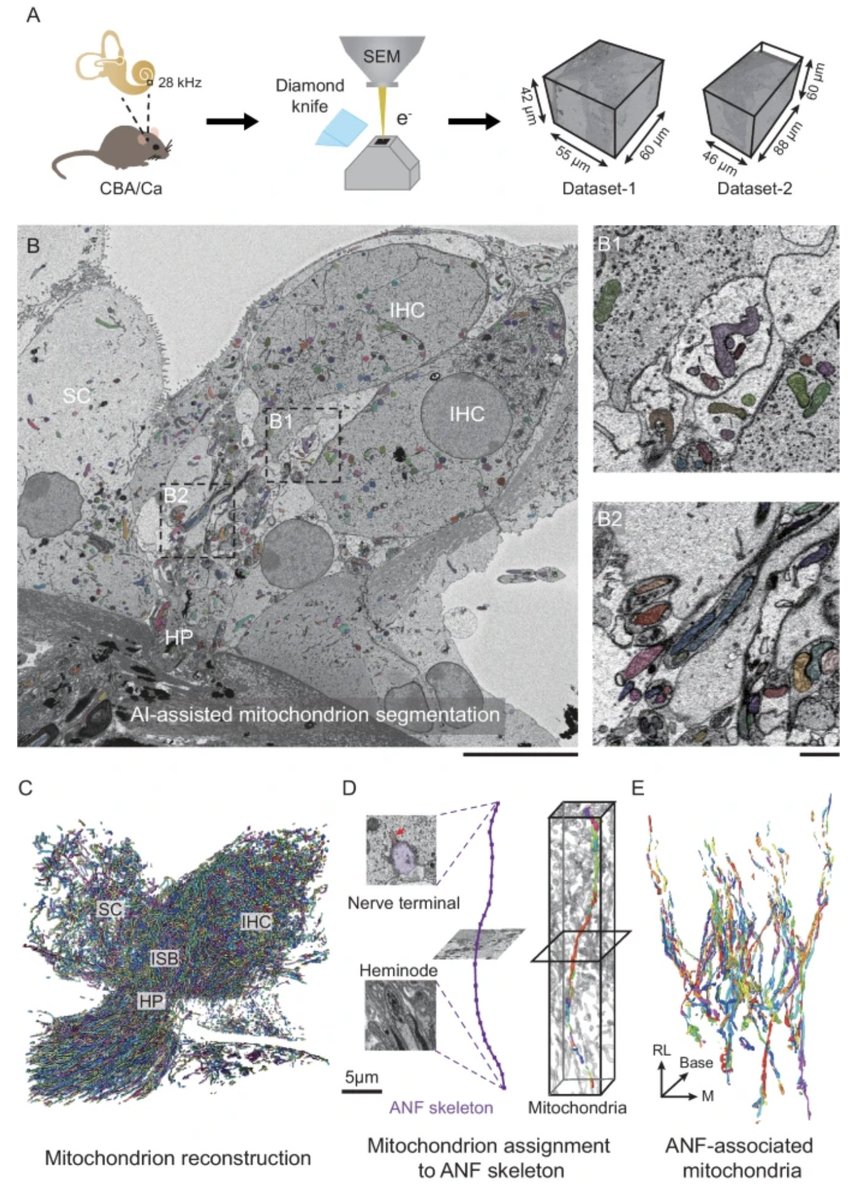 Stunning work from Lu et al. to map mitochondrias in auditory nerve fibers - check the article here!
rdcu.be/d9q8c