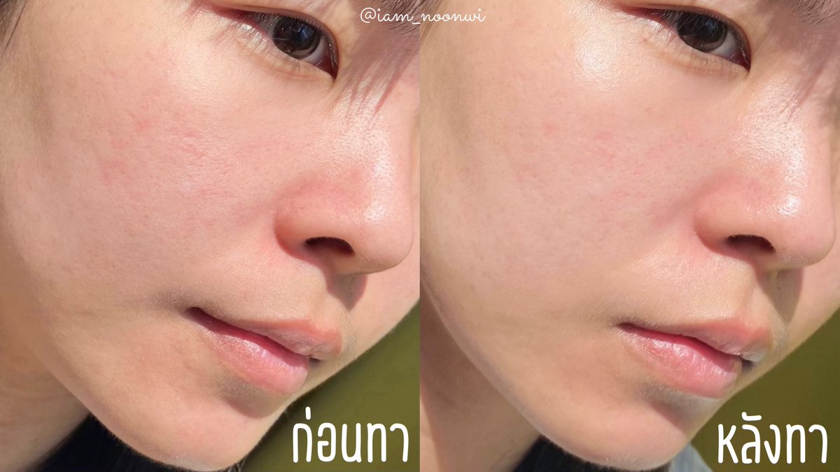 กันแดดเนื้อเซรั่ม #Skintific ~☀️ 

เนื้อกันแดดดีมากกก บางเบา ซึมง่าย สบายผิว ฟินิชผิวโกลว์นิดๆ มี Niacinamide ช่วยให้ผิวกระจ่างใส+สีผิวสม่ำเสมอ SPF50 PA++++ จะเซตแค่แป้งหรือแต่งหน้าต่อก็เอาอยู่ เพราะน้องไม่รบกวนเมคอัพ ใช้ได้ทุกวันเลย ดีจริง ชอบมากกก🥹 #ใช้ดีบอกต่อ https://t.co/Fy7TkUhNNH
