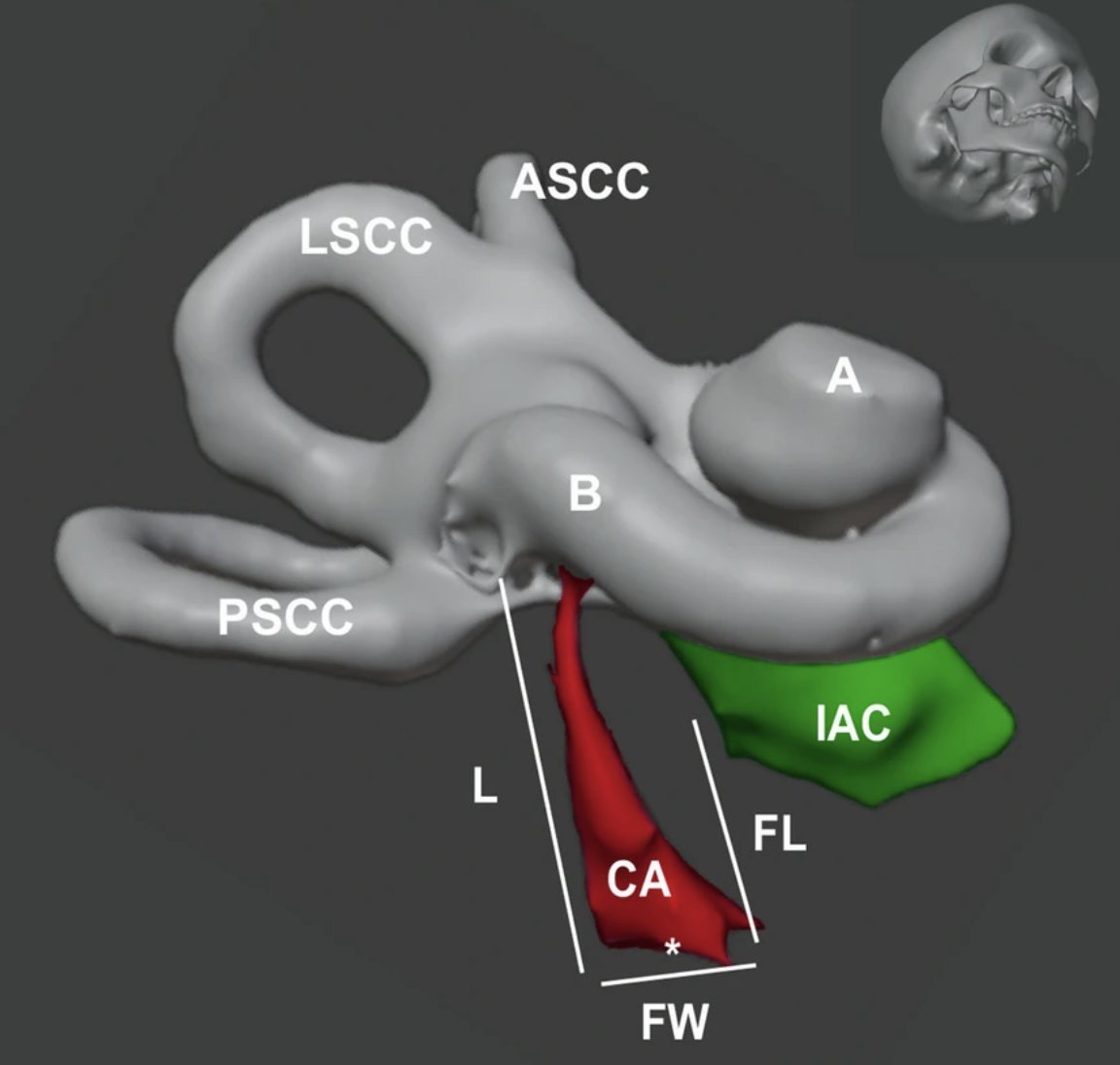 @JARO_News (@jaro_news) on Twitter photo The team from Fabian Blanc <a href="/INM_Montpellier/">INM_Montpellier</a> investigates the patency of the cochlear aqueduct in children and adults using high-resolution temporal bone computed tomography. Check the interesting findings here:
rdcu.be/d9ric The team from Fabian Blanc <a href="/INM_Montpellier/">INM_Montpellier</a> investigates the patency of the cochlear aqueduct in children and adults using high-resolution temporal bone computed tomography. Check the interesting findings here:
rdcu.be/d9ric