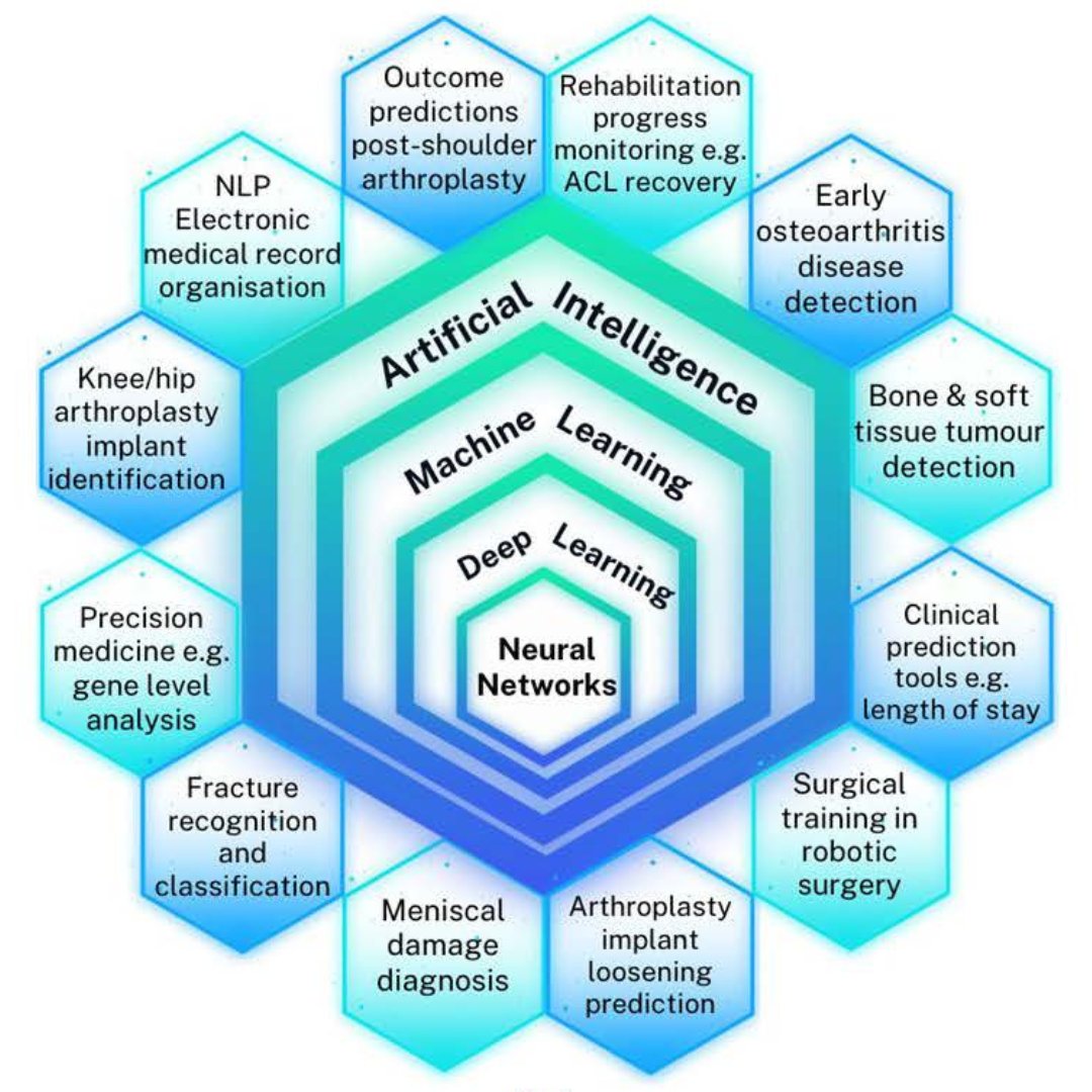 AI is showing promise as a useful tool in healthcare research and data science, including all aspects of patient care pathways.

#ArtificialIntelligence #OrthoTwitter #Healthcare <a href="/AFontalis/">Andreas Fontalis</a> <a href="/bjjeditor/">Prof Fares Haddad</a>

ow.ly/ecoF50UVObB