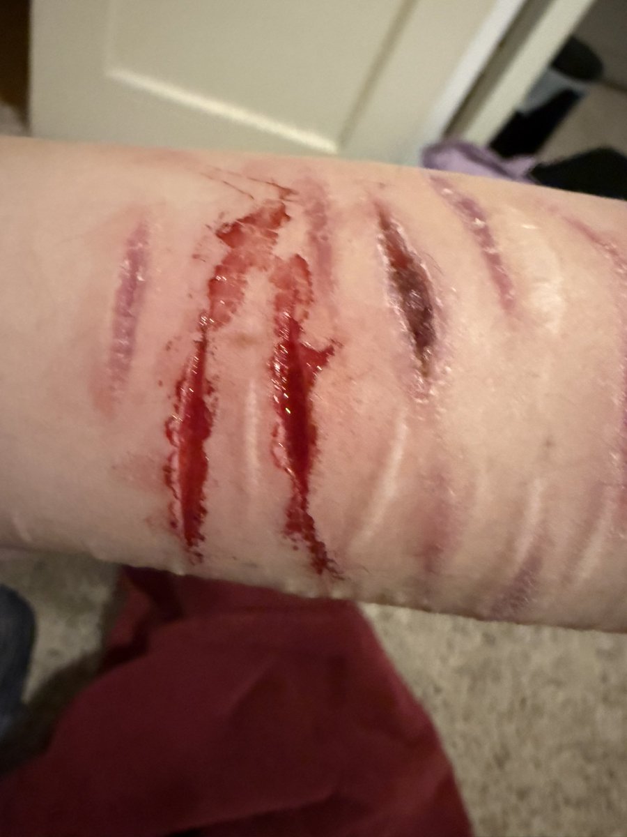 brooks_amy66506's tweet photo. Styro/bean sesh 🧵
Filling out my wrist (˶˃ ᵕ ˂˶)
#shtwt #shedtwt #barcodetwt #goretwt https://t.co/5Aydy1FAxH