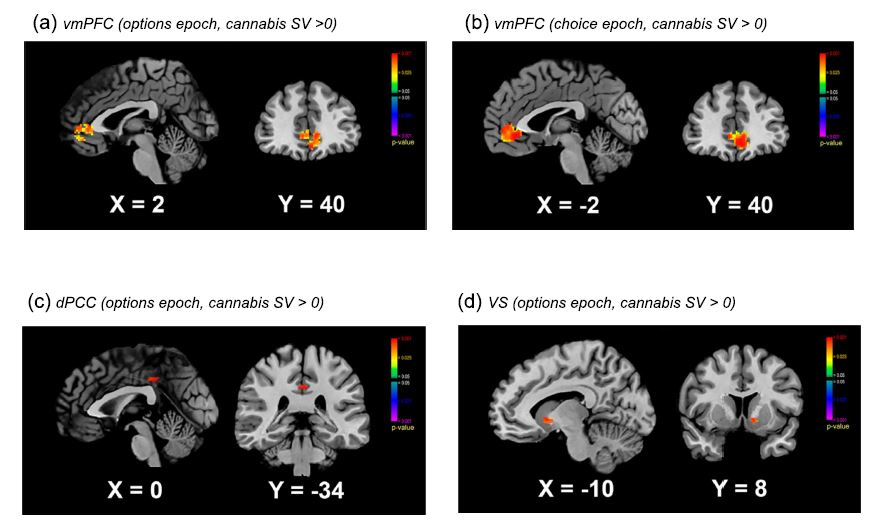 Will Lawn (@will_lawn) on Twitter photo 🚨New Paper - How does the brain value cannabis vs. snacks? 🍃🍔 Using fMRI & real purchases, we found strong cannabis value signals in reward regions (vmPFC, ventral striatum, dpCC), but not for snacks. Thanks to PI & lead author <a href="/GillBedi/">Gillinder Bedi</a>
🔗 Read more: link.springer.com/article/10.100… 🚨New Paper - How does the brain value cannabis vs. snacks? 🍃🍔 Using fMRI & real purchases, we found strong cannabis value signals in reward regions (vmPFC, ventral striatum, dpCC), but not for snacks. Thanks to PI & lead author <a href="/GillBedi/">Gillinder Bedi</a>
🔗 Read more: link.springer.com/article/10.100…