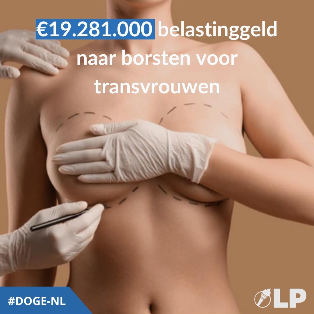 StemLP's tweet image. DOGE-NL
Iedereen is vrij om te doen met zijn of haar lichaam wat die wil, zolang dat maar niet betaald wordt met belastinggeld! Dit is geen efficiënte besteding van uw belastinggeld. 

#DOGENL