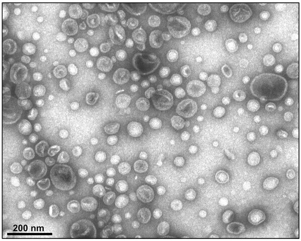 INRAE Occitanie-Toulouse (@inrae_tlse) on Twitter photo 🦠Pseudomonas aeruginosa est l’une des 5⃣ #bactéries les plus mortelles au🌍
Pour la 1⃣re fois un mécanisme complexe d’#antibiorésistance et de virulence a pu être décrit par une équipe <a href="/IrsdDe/">IRSD-Institut de Recherche en Santé Digestive</a>
💡Cette découverte majeure offre de nouvelles perspectives pour développer des 🦠Pseudomonas aeruginosa est l’une des 5⃣ #bactéries les plus mortelles au🌍
Pour la 1⃣re fois un mécanisme complexe d’#antibiorésistance et de virulence a pu être décrit par une équipe <a href="/IrsdDe/">IRSD-Institut de Recherche en Santé Digestive</a>
💡Cette découverte majeure offre de nouvelles perspectives pour développer des