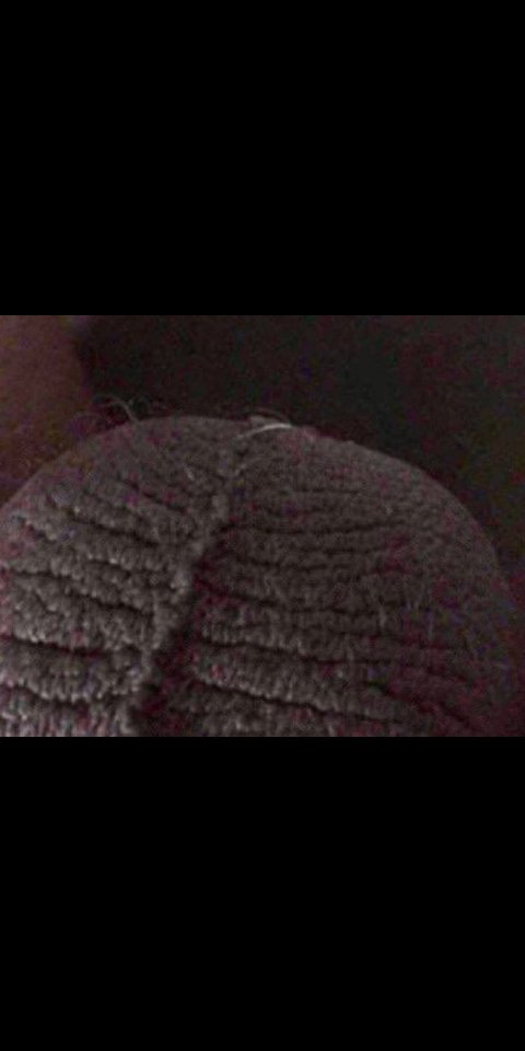 odnice2's tweet image. What part of the body is this?