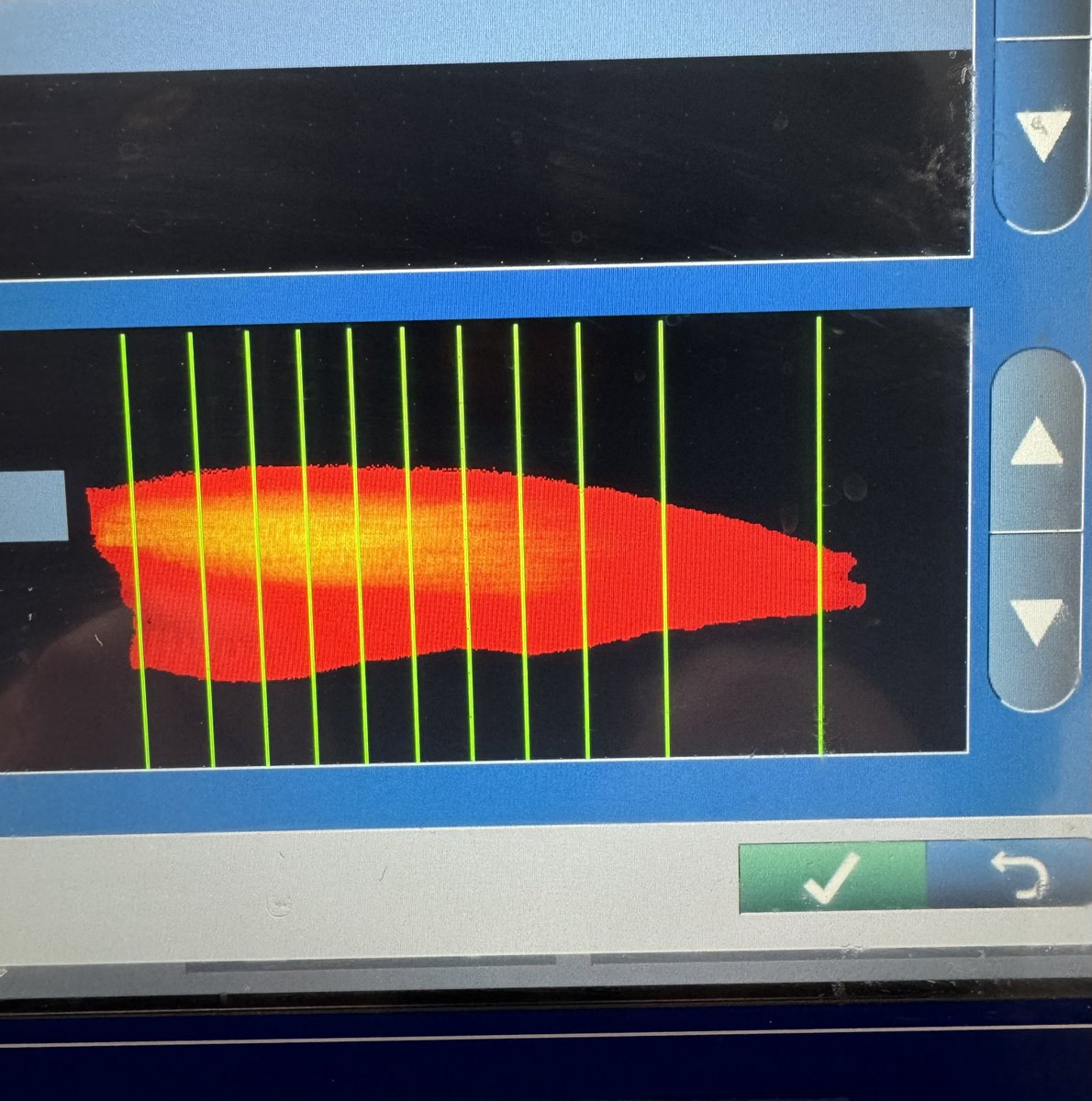 Talk to us today about your seafood portions👍
We can take the guesswork out of your cost control.