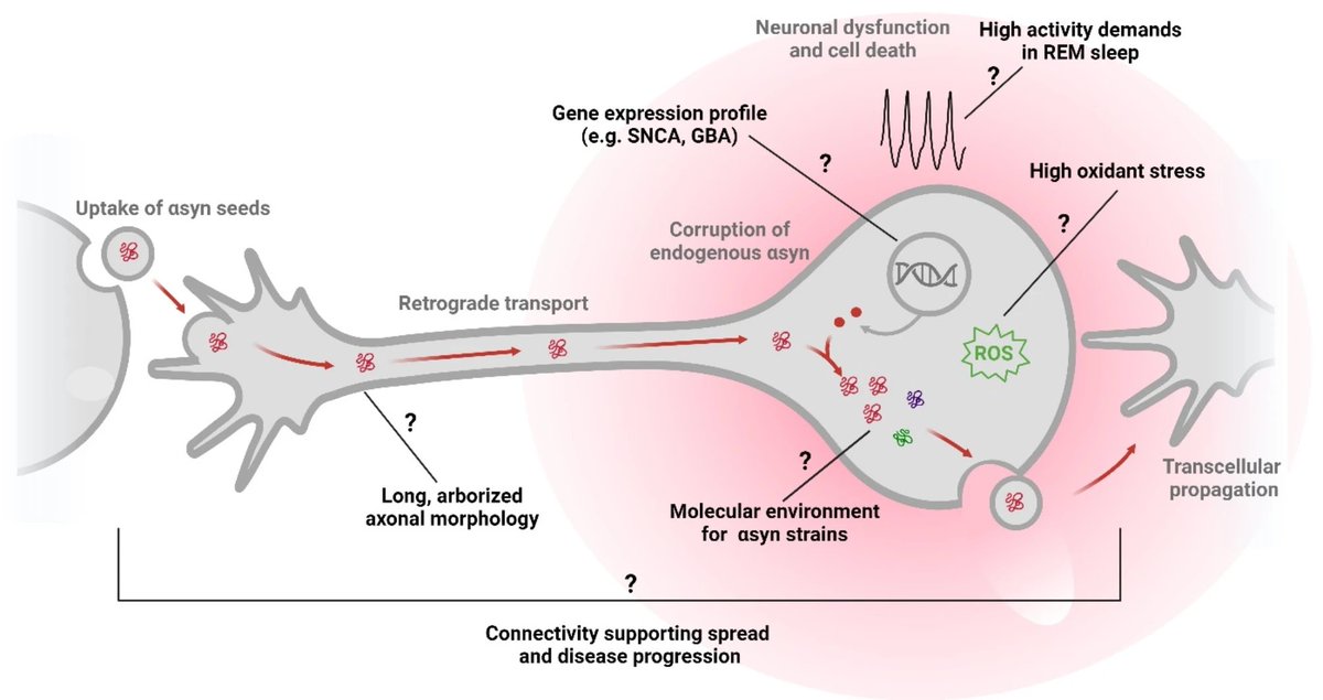 Molecular Neurodegeneration (@molneuro) on Twitter photo 'From mechanisms to future therapy: a synopsis of isolated REM #sleep behavior disorder as early #synuclein-related disease'
<a href="/AmbraStefani/">ambra stefani</a> Elena Antelmi <a href="/DarioArnaldi/">Dario Arnaldi</a>...Ziv Gan-O <a href="/ZivGanOr/">Ziv Gan-Or</a> <a href="/mcgillu/">McGill University</a> <a href="/TheNeuro_MNI/">The Neuro</a> #Parkinsons
bit.ly/4gESiWv 'From mechanisms to future therapy: a synopsis of isolated REM #sleep behavior disorder as early #synuclein-related disease'
<a href="/AmbraStefani/">ambra stefani</a> Elena Antelmi <a href="/DarioArnaldi/">Dario Arnaldi</a>...Ziv Gan-O <a href="/ZivGanOr/">Ziv Gan-Or</a> <a href="/mcgillu/">McGill University</a> <a href="/TheNeuro_MNI/">The Neuro</a> #Parkinsons
bit.ly/4gESiWv