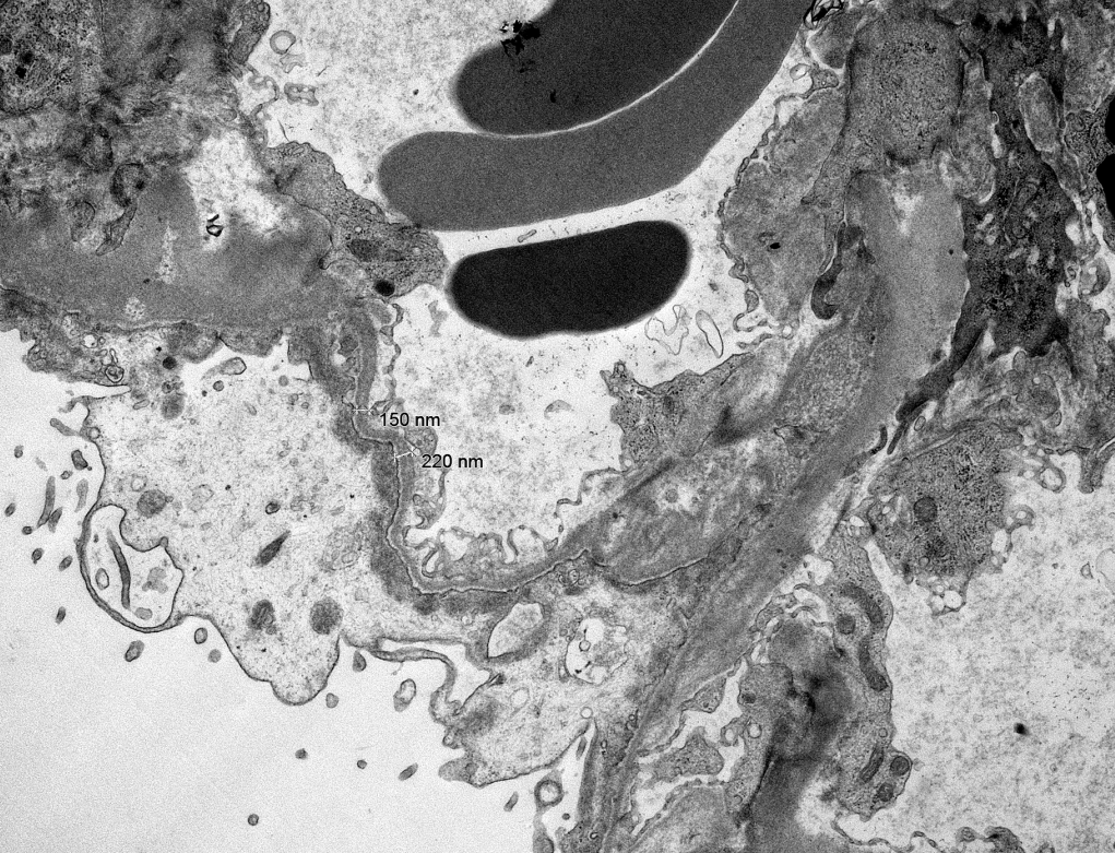 Jonathan Zuckerman MD PhD tweet media