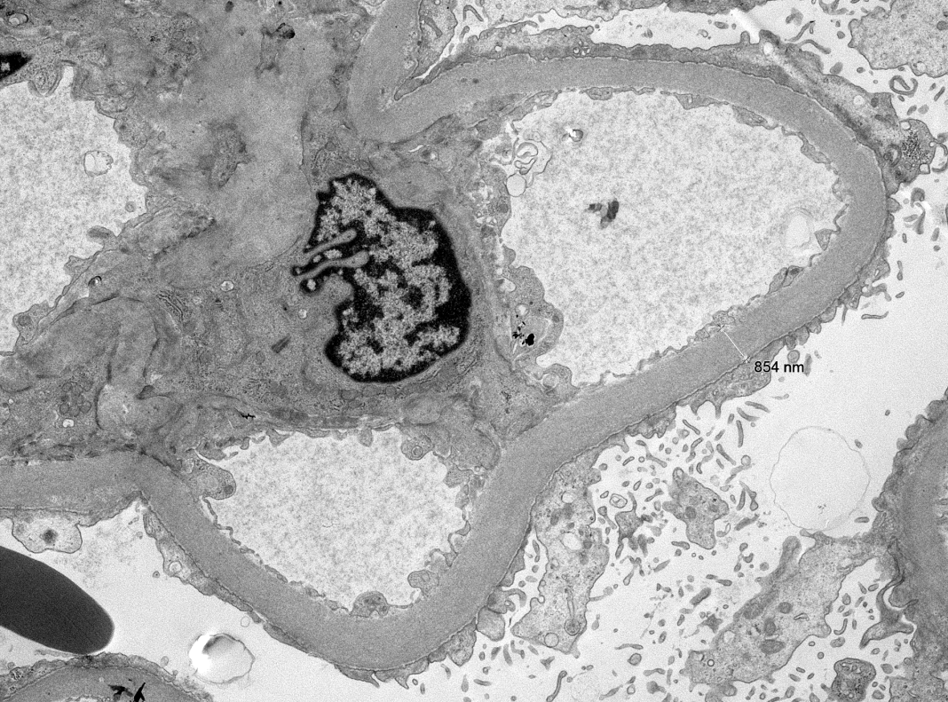 Jonathan Zuckerman MD PhD tweet media