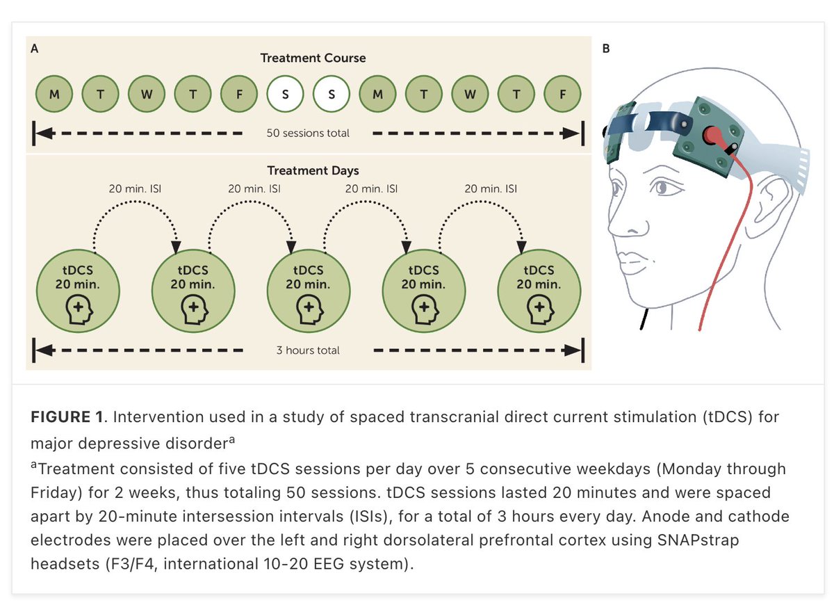 "Spaced Transcranial Direct Current Stimulation for Major Depression"  | @DrMiron_MD et al in American Journal of Psychiatry psychiatryonline.org/doi/10.1176/ap…
With accelerated tDCS dosing, increased important on optimized equipment/electrodes.