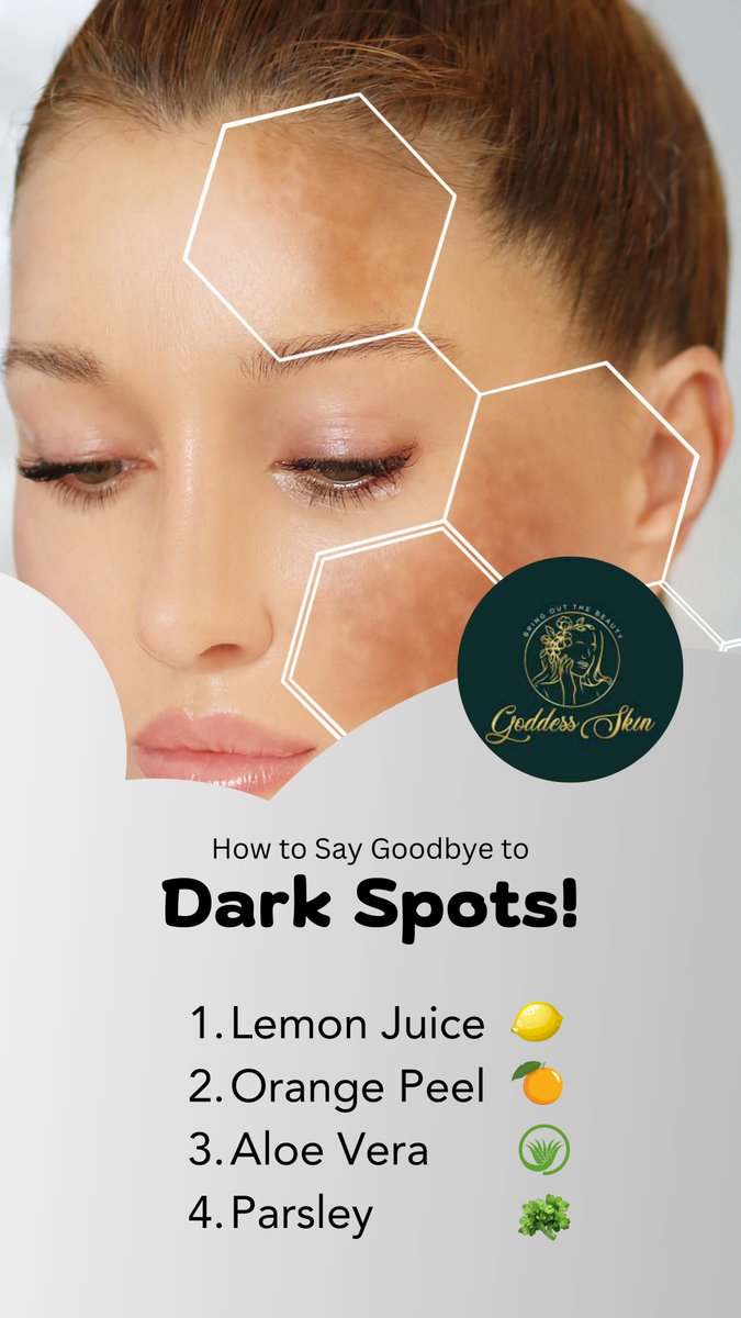 GoddessSkinLLC's tweet photo. Natural Remedies to Get Rid of Dark Spots! 🍋✨

🍋 Lemon Juice 
🍊 Orange Peel 
🌱 Aloe Vera
🌿 Parsley

Stay consistent and watch your skin glow naturally! ✨💛

#DarkSpots #NaturalSkincare #LemonJuice #OrangePeel #AloeVera #Parsley #SkincareTips #ClearSkin #GlowUp #RadiantSkin https://t.co/uKq2bNwosW