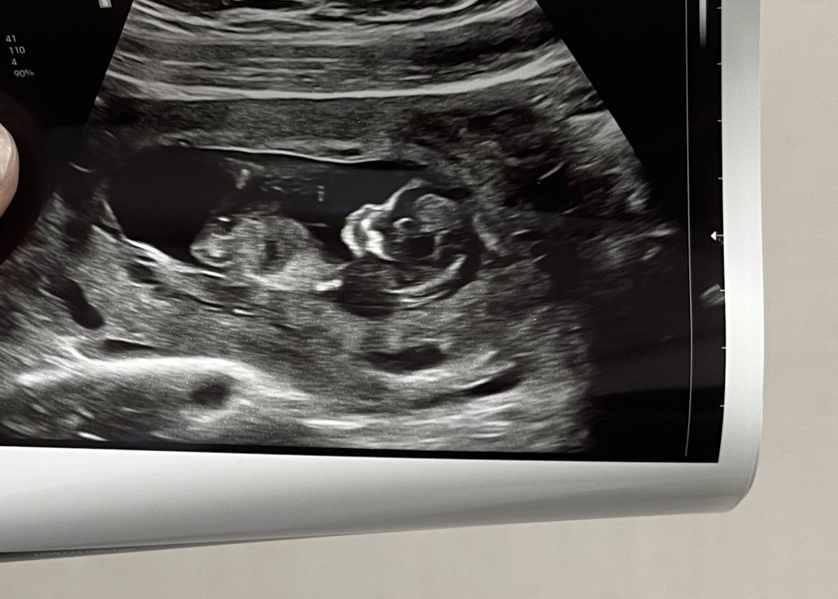 Lotionthepotion's tweet image. LFG #2 is on the way