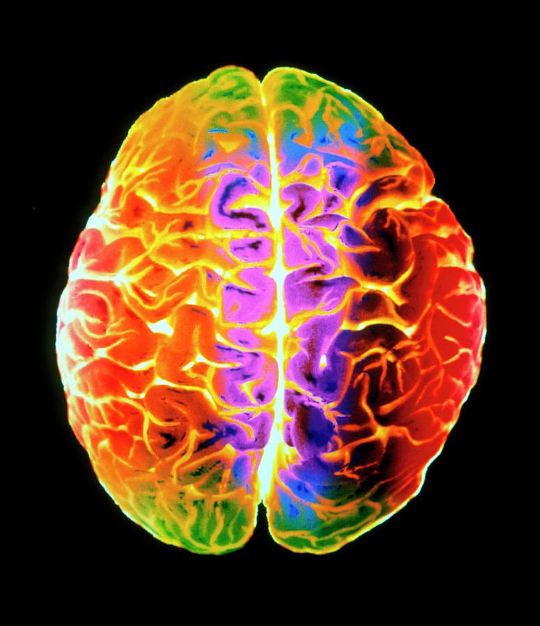 PropositoyVida's tweet image. La cúrcuma es el fármaco número uno para curar la inflamación.

Reduce el riesgo de cáncer, reduce la inflamación entre un 30 y un 50% y fortalece el sistema inmunológico.

Aquí te explico cómo utilizarla correctamente y obtener todos los beneficios (basados ​​en la ciencia):🧵