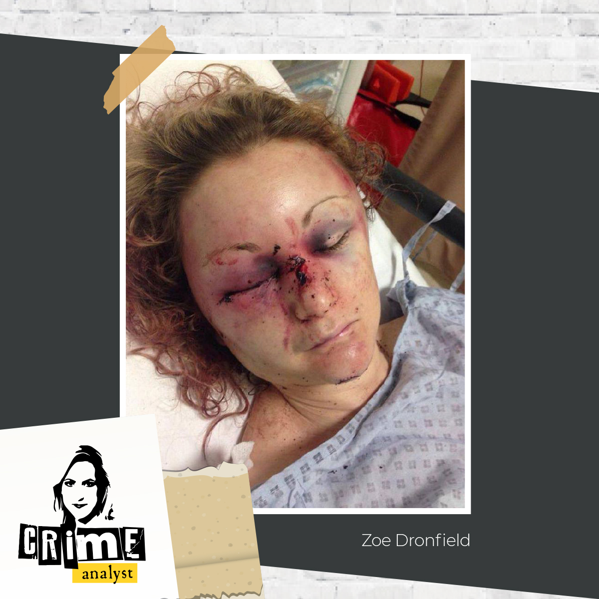 This is so important. Victims of domestic abuse deserve justice, but the system has failed them for too long. 

The picture is upsetting - the point is that you should see what this serial perpetrator did to Zoe. He almost killed her AND this could have been prevented. Police