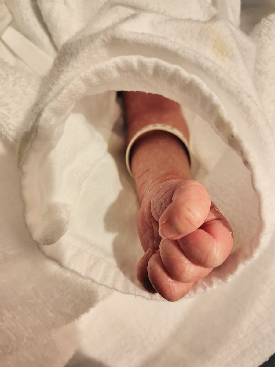 k_a3ktmn's tweet photo. 私事ですが先日男の子を出産しました✨️
小さくて可愛いお手々を自慢させてください😊

程よいところで一旦劇場おさめするつもりが体��不良で電車に乗れなくなったのはかなり誤算でしたが、配信で色々見られるのはかなり助かりますね。落ち着いたらまた現場に行きたいです〜😌 https://t.co/JdxGaAk14O