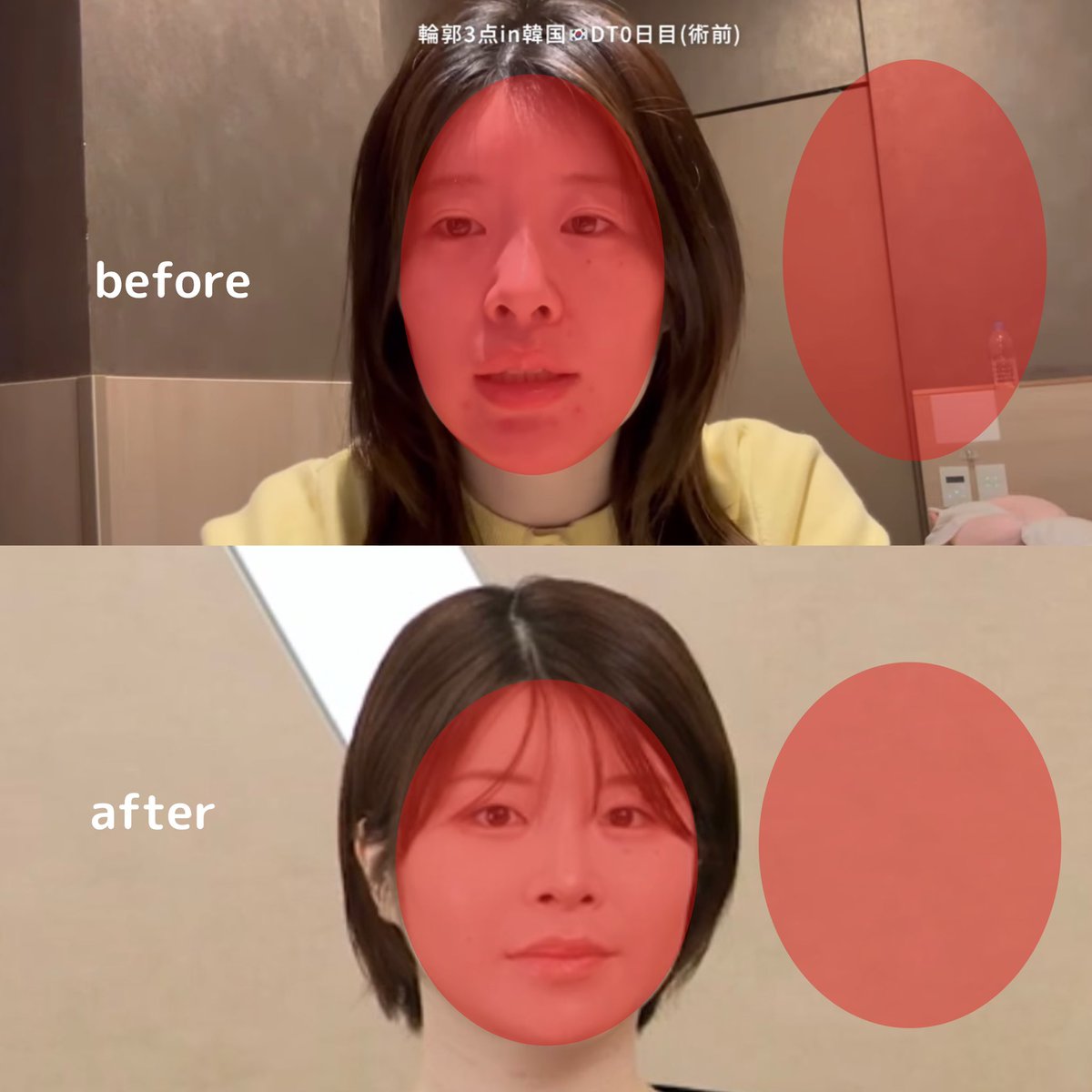 noechinosub's tweet photo. 死ぬ気で1年で面長から丸顔に近づけた！！！どっちも動画の切り抜きで無加工🎥 https://t.co/o8YSvV2Ejc