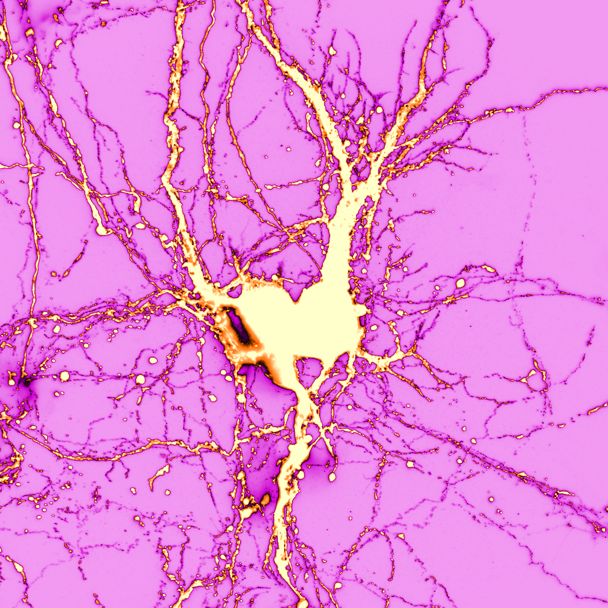 iins_bordeaux's tweet photo. #FridayPicture🖼️For #Valentinesday2025💝 "Must be love on the brain"🎵 at @iins_bordeaux with "Love in the brain"💚🧠 by Léa Sarzynski
Caption
Primary hippocampal neurons transfected with soluble dTomato (DIV21)
@Neuro_Bordeaux @CNRSAquitaine @CNRSbiologie @CNRS @univbordeaux https://t.co/5DayLgx43W