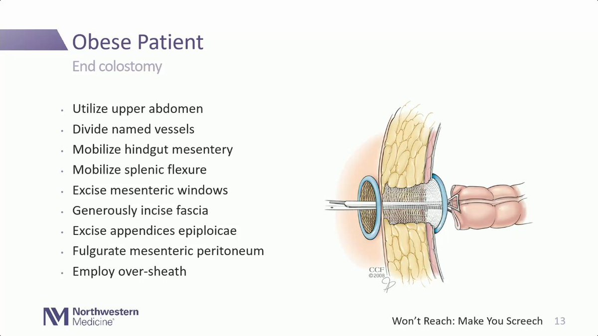 sepdigestiva's tweet image. Algunas maniobras y tips para la creación de colostomías difíciles.