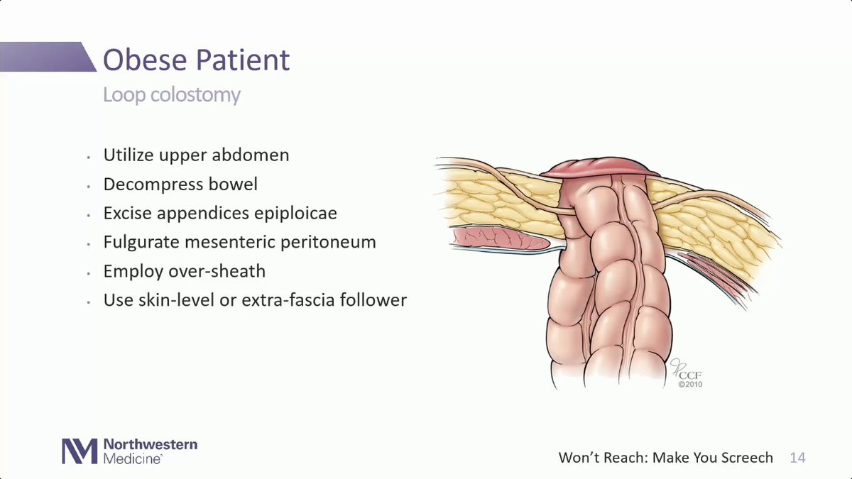 sepdigestiva's tweet image. Algunas maniobras y tips para la creación de colostomías difíciles.