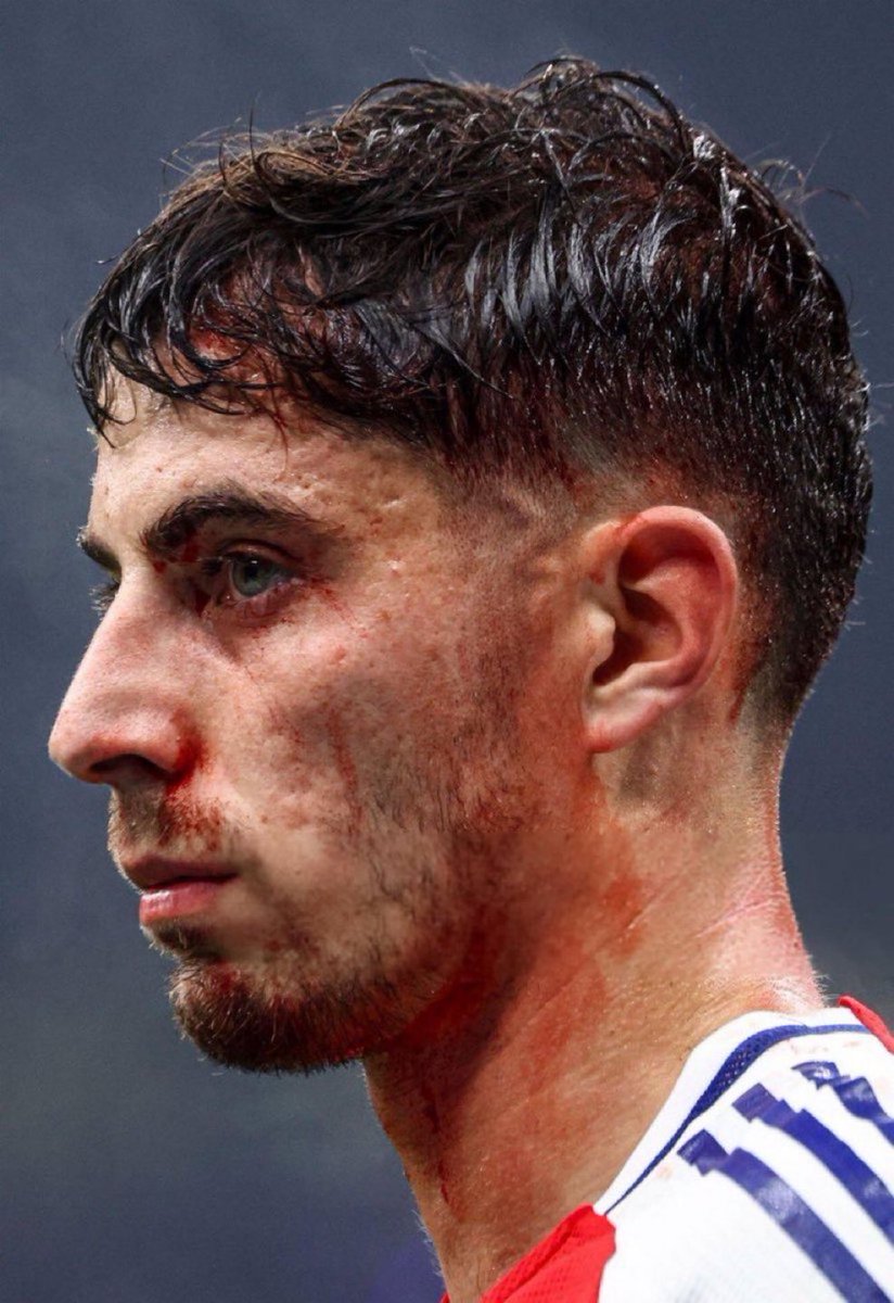 PatrickTimmons1's tweet photo. Overplayed. Ran himself into the ground every single game. Played through knocks and injuries. The club didn’t sign any competition in January to lessen his workload. 

He doesn’t deserve this. 💔 https://t.co/ESduFkyqSS