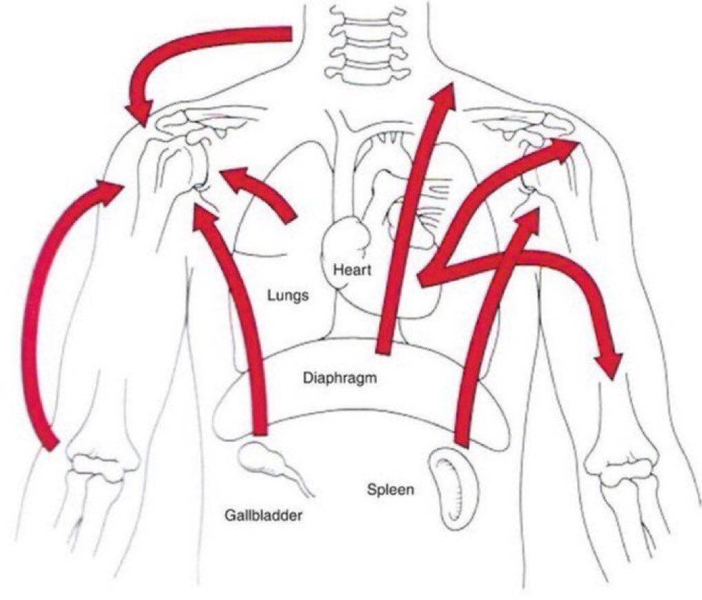 OGdukeneurosurg's tweet photo. Causes of shoulder pain besides the shoulder… examples:
Aortic dissection 
Phrenic nerve 
Cardiac 
Gallstones
PE https://t.co/XGJMQ7X4VS