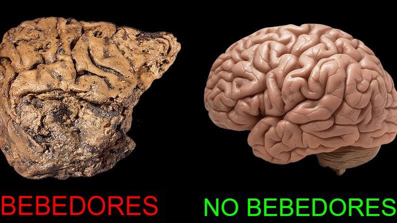 Cómo arreglar tu cerebro frito por la dopamina de forma permanente.

Todo comienza con estos 7 sencillos cambios en el estilo de vida:

1) Deja de beber alc*hol.