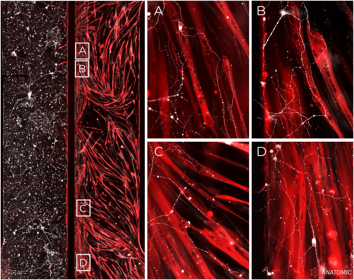 AnatomicTech's tweet image. 🔬👩‍🔬Twitch isn’t only for gamers. See motor neuron-induced myofiber contraction in our neuromuscular junction (NMJ) assay using Anatomic’s new RealMOTO hiPSC-derived motor neurons! 

#CompleteTheCircuit #NotYourAverageNeuron #ALS #CMT #StemCells #Microfluidics