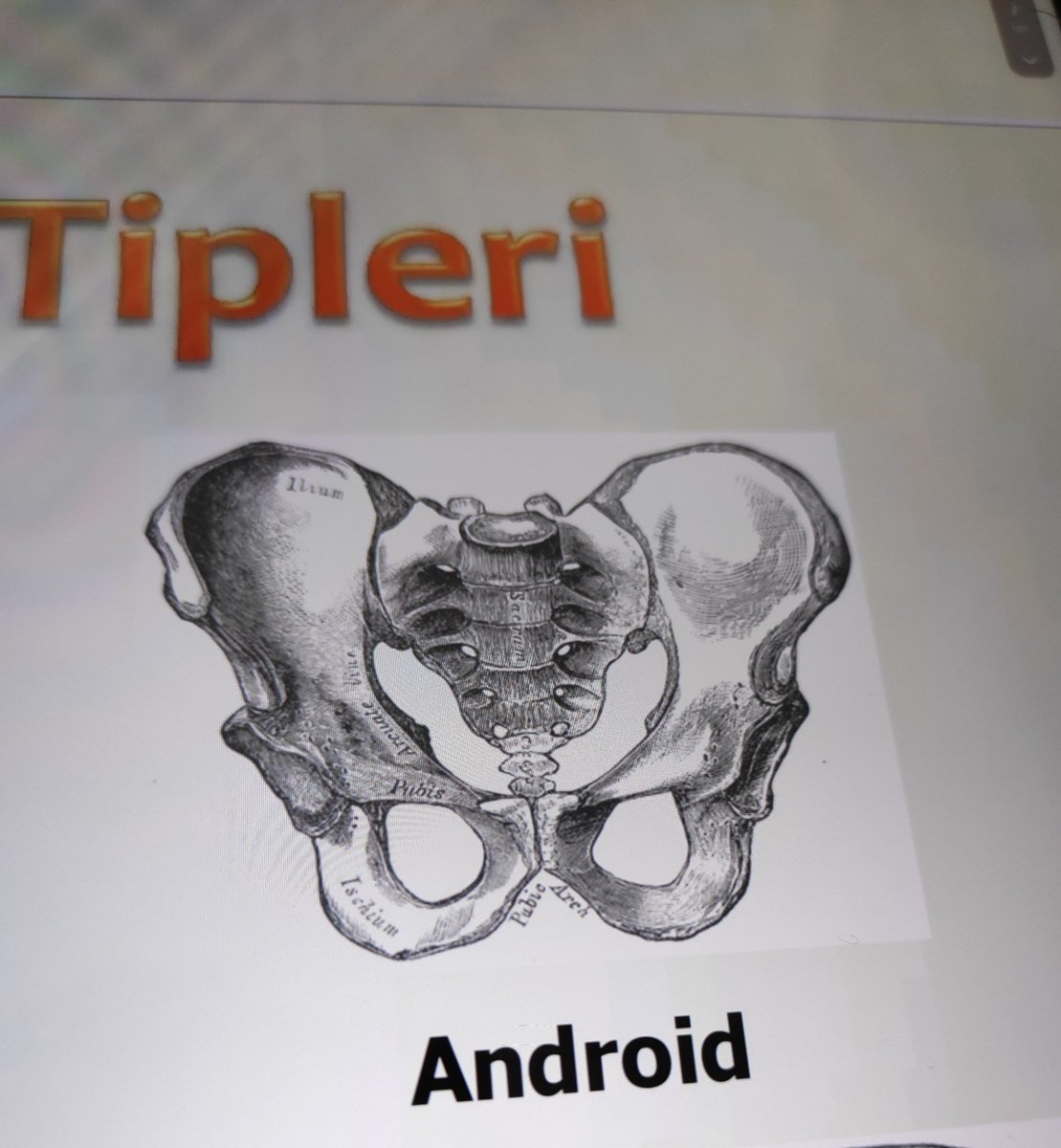 baki_arslan46's tweet photo. İphonedan başka telefon kullanmam diyenlerin pelvis tipi ( erkek tipi pelvis olduğunu biliyorum ) https://t.co/LdEQ6JgvIl