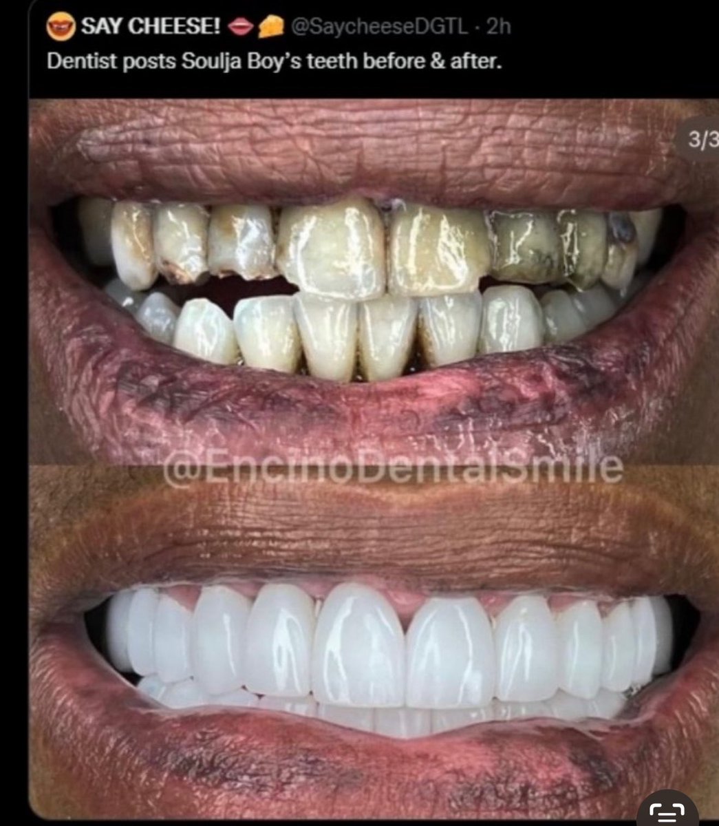 Tell me <a href="/souljaboy/">Soulja Boy (Draco)</a> didn’t smoke crack. Look at the hot crackpipe burns on his lips.  And them teeth look like they sayin’ “I’ll suck yo d***”