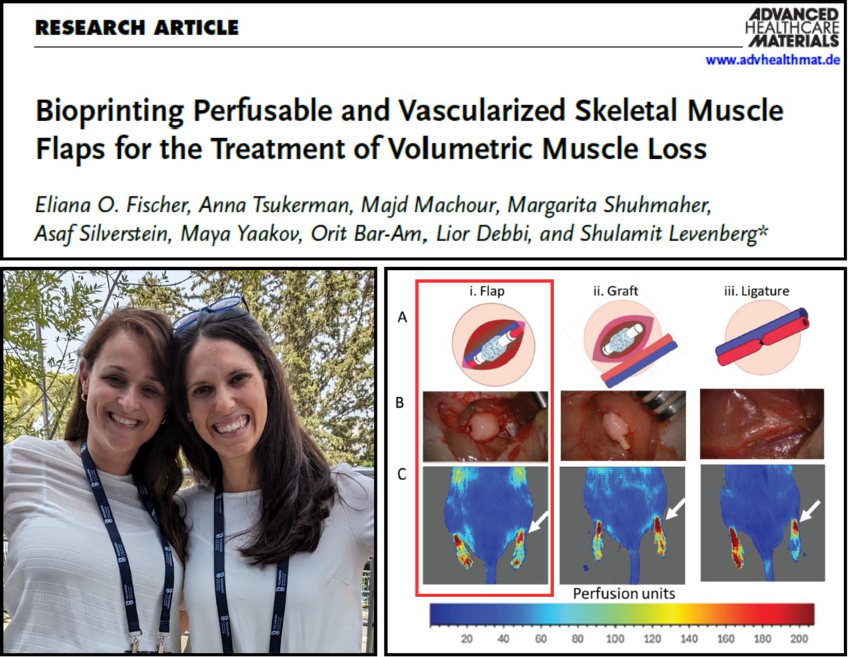 Levenberg Lab (@levenberglab) on Twitter photo Our latest study in <a href="/AdvPortfolio/">Advanced Portfolio News</a> introduces a novel multimodal bioprinting approach for thick, vascularized skeletal muscle flaps with a 3D-printed macrovessel.
📖 Read more: lnkd.in/dUt8pNqA
#TissueEngineering #RegenerativeMedicine #Bioprintin Our latest study in <a href="/AdvPortfolio/">Advanced Portfolio News</a> introduces a novel multimodal bioprinting approach for thick, vascularized skeletal muscle flaps with a 3D-printed macrovessel.
📖 Read more: lnkd.in/dUt8pNqA
#TissueEngineering #RegenerativeMedicine #Bioprintin
