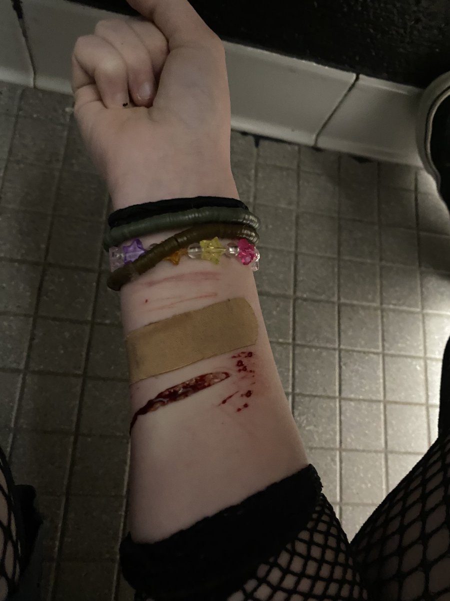 I received 10 stitches for my 🫘 cut today.