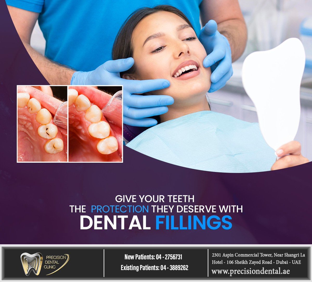 precisiondxb's tweet photo. If you have a cavity in your smile or decayed teeth that require treatment, dental fillings can restore your teeth and prevent further damage. Schedule a consultation at https://t.co/hWX6HImAhd and protect your smile. #fillings #precisiondentalclinic #dubai https://t.co/s5UXFnkT9K