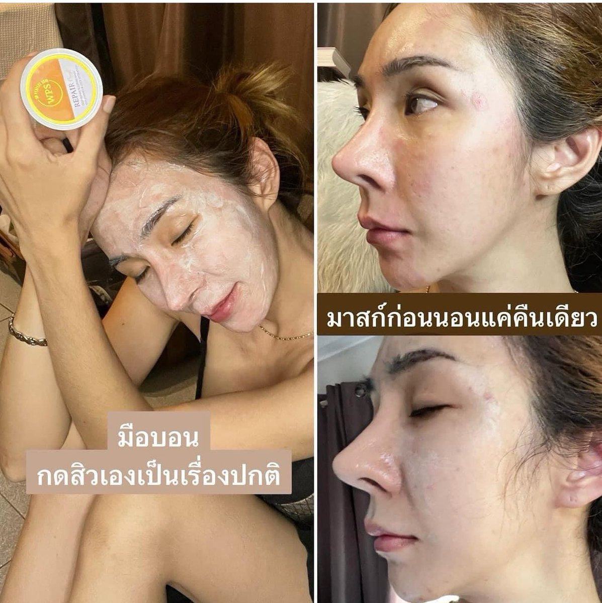 appleindy_ps's tweet photo. หลุมสิวตื้นขึ้น ผิวเรียบเนียนขึ้นได้จิงด้วย WPS‼️

มาส์กน้ำนม ช่วยฟื้น ฟู สภาw ผิวช่วยให้ผิวเปล่งปลั่ง กระจ่างใส อุ้ม น้ำ 😆💋

🫧🛁🌪🕊🌿
M A S K … W P S 〰️(•¥•) ✔️

®️.. 📢Line: ple_7234 
♾️♾️ 🛒 ส่งของทุกวัน https://t.co/JpRAH1ih8X
