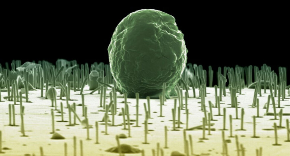 Nano Letters (@nanoletters) on Twitter photo PEDOT is going one-dimensional! Lithography-free conductive polymer nanowires were interfaced with both algae and human blood stem cells paving the way for 1D organic bioelectronics. <a href="/lunduniversity/">Lund University</a> @nanolund <a href="/MultiparkL/">MultiPark at LundU</a> <a href="/HjortsX/">martin hjort</a> <a href="/OlssonRoger/">Roger Olsson</a>
go.acs.org/chH PEDOT is going one-dimensional! Lithography-free conductive polymer nanowires were interfaced with both algae and human blood stem cells paving the way for 1D organic bioelectronics. <a href="/lunduniversity/">Lund University</a> @nanolund <a href="/MultiparkL/">MultiPark at LundU</a> <a href="/HjortsX/">martin hjort</a> <a href="/OlssonRoger/">Roger Olsson</a>
go.acs.org/chH