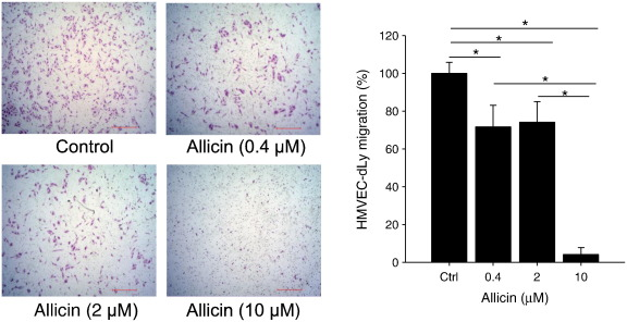AllicinV's tweet image. #Allicin, the most abundant organosulfur compound in freshly crushed garlic tissues, has been shown to have various health-promoting effects, including #anticancer actions. A better understanding of the effects and mechanisms of allicin on #tumorigenesis could facilitate