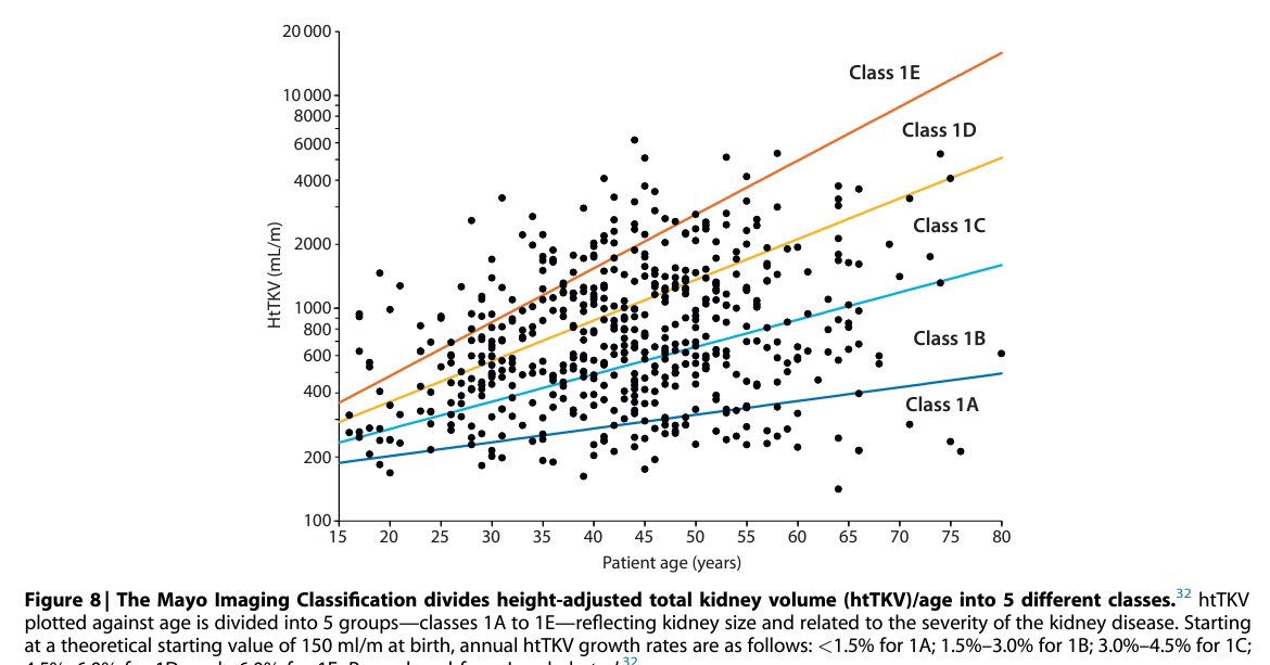 ✅Why is it Class 1A-1E and not class 1-5 in MIC (Mayo imaging classification)?
✅That’s because Class 1️⃣ is Typical ADPKD and Class 2️⃣ is atypical ADPKD.
✅Checkout what’s typical and atypical ADPKD 👇
✅However, note that the predictive tool is valid for typical category only