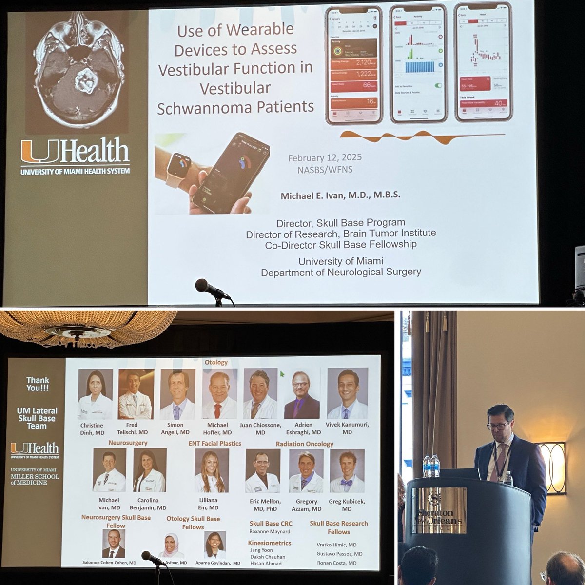 The Yang Lab (@theyanglab1) on Twitter photo A very innovative use-case of kinesiometrics and wearable technology for Vestibular Schwannoma treatment and care by <a href="/michaelivanmd/">Michael Ivan, MD, MBS, FAANS</a>. #NASBS2025 <a href="/NASBSorg/">NASBS</a> <a href="/UMneurosurgery/">UM Neurosurgery</a> <a href="/umiamimedicine/">Miller Medicine</a>
<a href="/IsaacYangMD/">Isaac Yang MD</a> <a href="/UCLANsgy/">UCLA Neurosurgery 🧠</a> <a href="/UCLA_ENT/">UCLA Head & Neck Surgery</a> <a href="/UCLAHealth/">UCLA Health</a> <a href="/dgsomucla/">David Geffen School of Medicine at UCLA</a> <a href="/HarborUCLA/">Harbor-UCLA Medical Center</a> <a href="/HarborUCLASurg/">Harbor-UCLA Surgery</a> A very innovative use-case of kinesiometrics and wearable technology for Vestibular Schwannoma treatment and care by <a href="/michaelivanmd/">Michael Ivan, MD, MBS, FAANS</a>. #NASBS2025 <a href="/NASBSorg/">NASBS</a> <a href="/UMneurosurgery/">UM Neurosurgery</a> <a href="/umiamimedicine/">Miller Medicine</a>
<a href="/IsaacYangMD/">Isaac Yang MD</a> <a href="/UCLANsgy/">UCLA Neurosurgery 🧠</a> <a href="/UCLA_ENT/">UCLA Head & Neck Surgery</a> <a href="/UCLAHealth/">UCLA Health</a> <a href="/dgsomucla/">David Geffen School of Medicine at UCLA</a> <a href="/HarborUCLA/">Harbor-UCLA Medical Center</a> <a href="/HarborUCLASurg/">Harbor-UCLA Surgery</a>