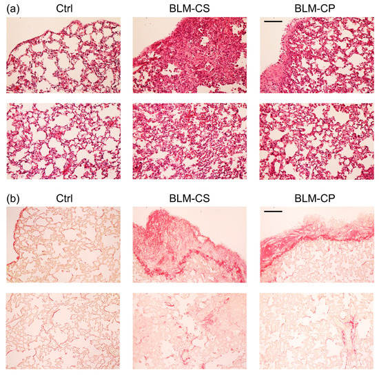 BiologicsMDPI (@biologicsmdpi) on Twitter photo ✍️ Editor’s Choice Paper
"Administration of Collagen Peptide Prevents the Progression of Pulmonary Fibrosis in Bleomycin-Treated Mice"
📚By Minami Yoshihara et al.
📖 Full text: mdpi.com/2673-8449/3/3/…
#PulmonaryFibrosis #CollagenPeptides #FibrosisTreatment
<a href="/MDPIBiologySubj/">MDPI Biology</a> ✍️ Editor’s Choice Paper
"Administration of Collagen Peptide Prevents the Progression of Pulmonary Fibrosis in Bleomycin-Treated Mice"
📚By Minami Yoshihara et al.
📖 Full text: mdpi.com/2673-8449/3/3/…
#PulmonaryFibrosis #CollagenPeptides #FibrosisTreatment
<a href="/MDPIBiologySubj/">MDPI Biology</a>