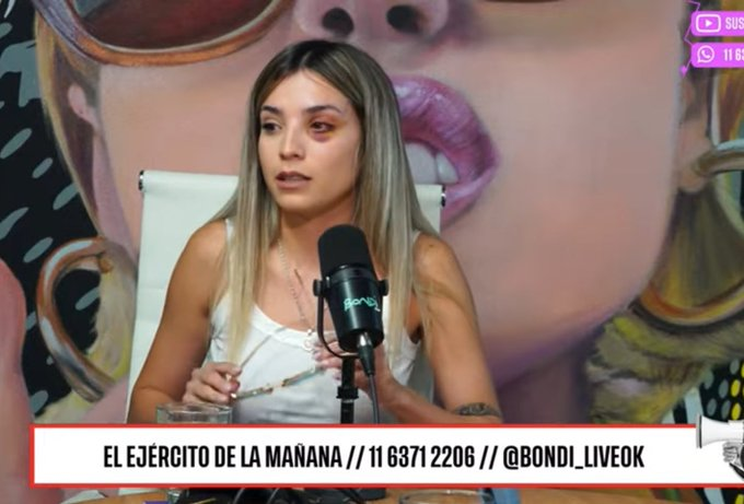 Mon1ca_GeIIer's tweet photo. Tremendo escuchar a Emily de Love is Blind Mostrando los golpes, denunciando en la justicia y en los medios. Su mamá llorando con ella. Terrible terrible https://t.co/FjiccXxcT6