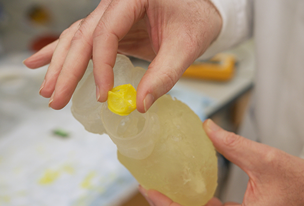 Coulter BME | Emory & Georgia Tech (@coulterbme) on Twitter photo A heart valve that grows with you? <a href="/CoulterBME/">Coulter BME | Emory & Georgia Tech</a>'s Lakshmi Dasi & Scott Hollister are developing a 3D-printed, bioresorbable heart designed to adapt to a patientās anatomy over timeāpotentially reducing the need for repeat surgeries, especially in children. bit.ly/41amlRf A heart valve that grows with you? <a href="/CoulterBME/">Coulter BME | Emory & Georgia Tech</a>'s Lakshmi Dasi & Scott Hollister are developing a 3D-printed, bioresorbable heart designed to adapt to a patientās anatomy over timeāpotentially reducing the need for repeat surgeries, especially in children. bit.ly/41amlRf