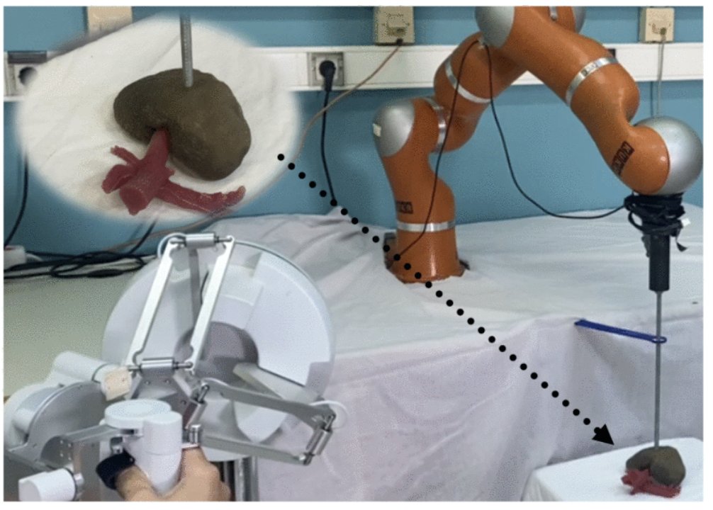 IeeeTro's tweet image. A passive bilateral control framework for #RAMIS that handles communication delays while maintaining precise instrument control. The system ensures safety near sensitive structures using remote center of motion constraints 
ieeexplore.ieee.org/document/10758…
#SurgicalRobotics