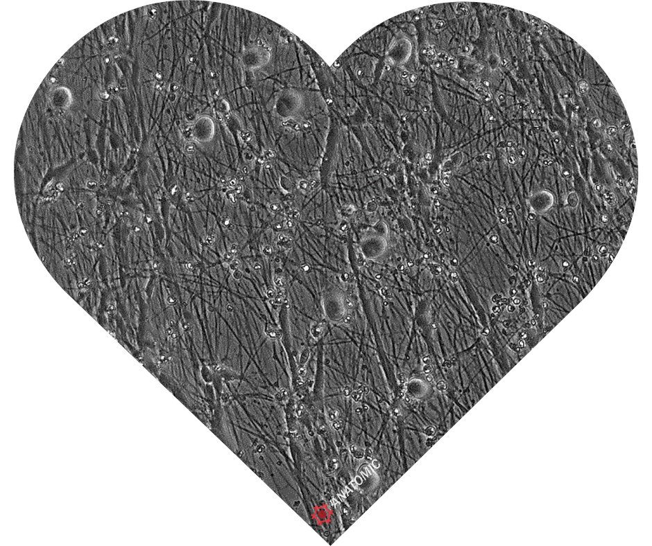 AnatomicTech's tweet image. Sensory neurons and Schwann cells are better together❣️Whether you are single or have date night plans, this is a scientific love story that you can study this Valentine’s day.
#CompleteTheCircuit #NotYourAverageNeuron #PainResearch #CoCultures #CMT